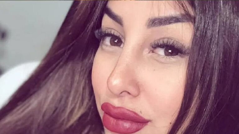 El impactante cambio de Tamara Báez a cuatro meses de su liposucción: las imágenes